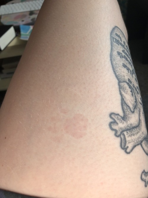 invisiblelovestory: First she sits on me so hard she leaves a perfect paw print. Then doesn’t 