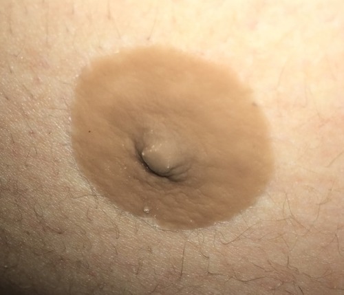 ftmproductreviews:GenderMender ftm prosthetic nipples!Hey guys today I’m going to tell you about a c