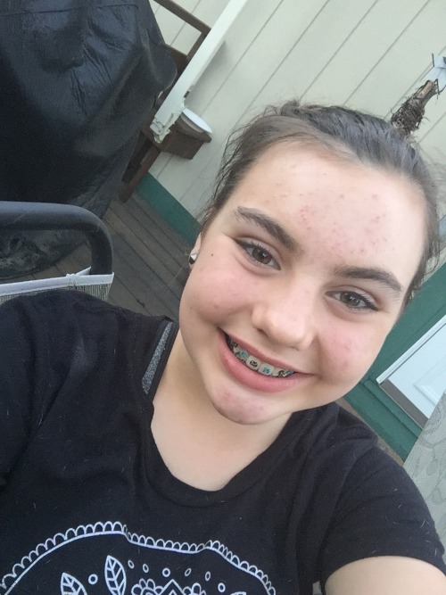 venomkillertaipan: Ugly even without braces Cute Don&rsquo;t care what she says