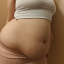 overfedmommy