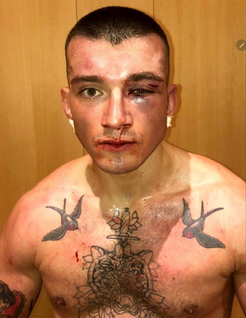 Bareknuckle Fight