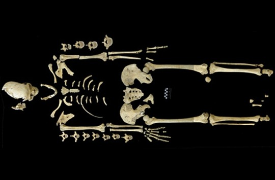 Oldest Case of Leukemia Found on 7,000-Year-Old Skeleton