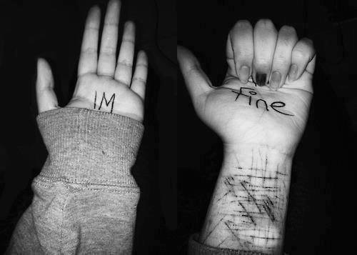 meelissa-crbyn:  I’m fine.