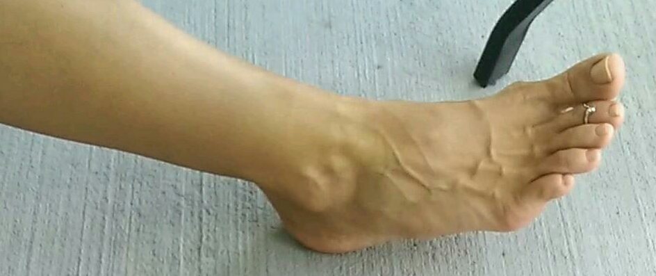 My foot fetish