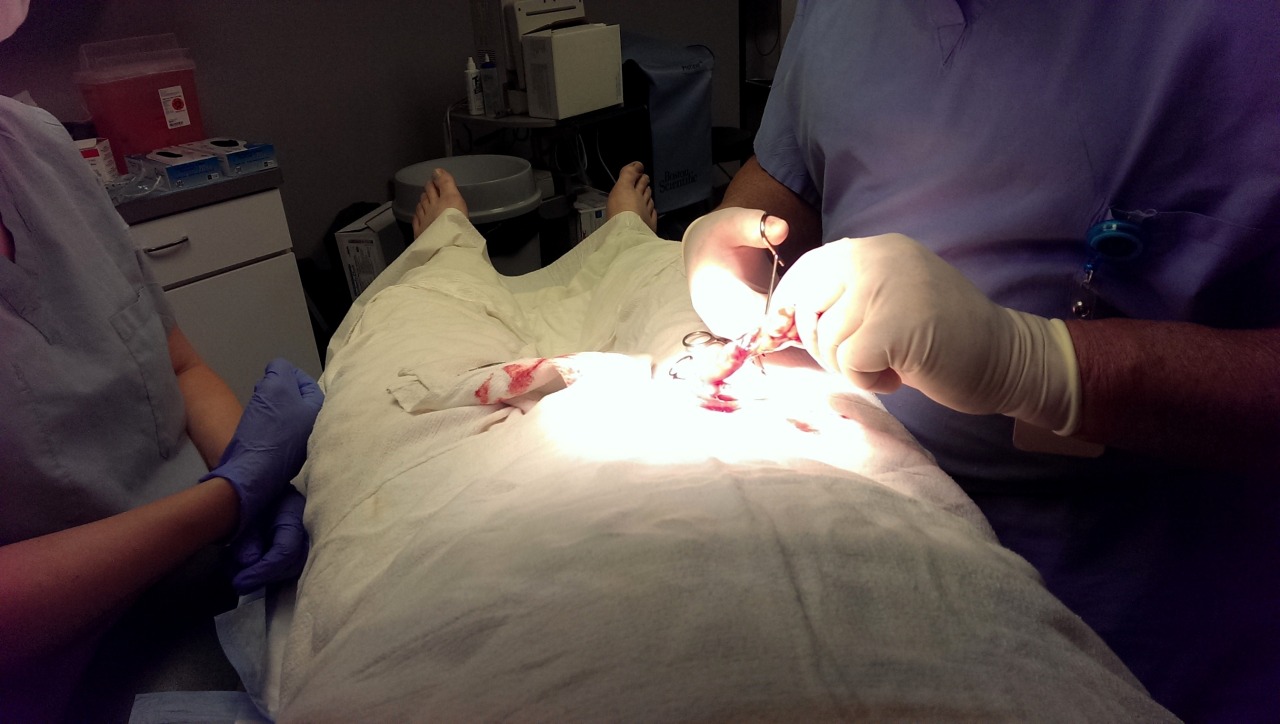 miah-akston:  Before&gt; during&gt;removed&gt;diapersftw&gt;incision&gt;swollen&gt;superlongdraintube