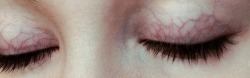 flowerette:  my sister has eyelids like this