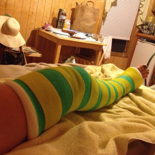kastboy:#legcast #longlegcast #greencast #yellowcast #foot #feet #leg #legs #toes #blacktoenails #fo