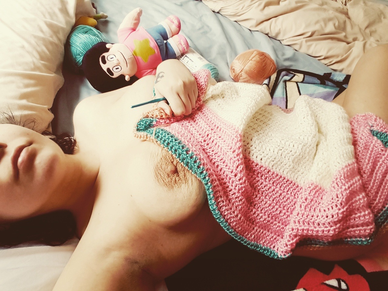 angiev13:  Scars and imperfections 💚