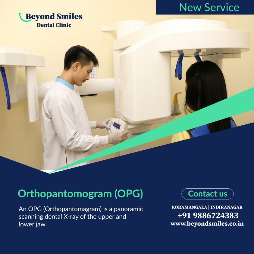 Orthopamtromogram(OPG)|Beyond Smiles Dental Clinic | Dental Clinic Indiranagar