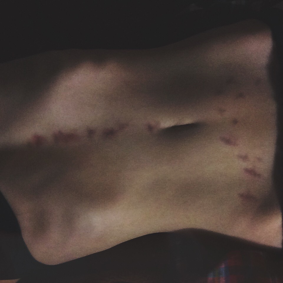trvp-g0ld:  a little bit of you still left on my skin