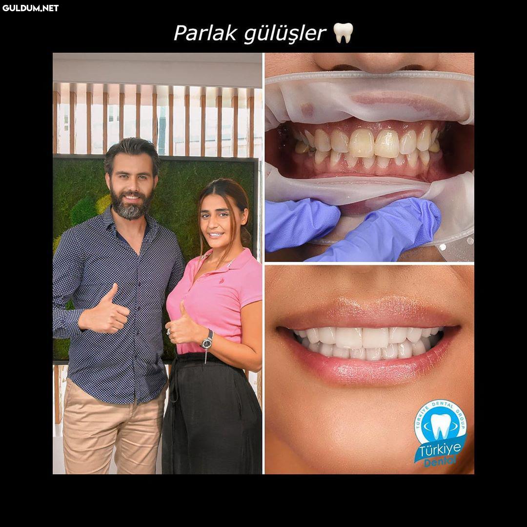 @turkeydental 👈...