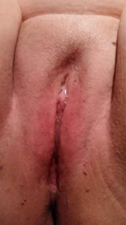 sexycountrybitch03:  Showing ass in public made my pussy this wet and clit swollen.