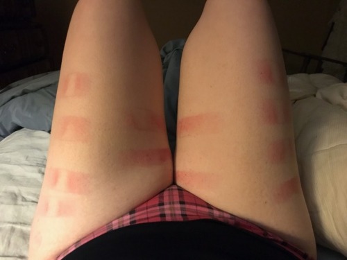 purrr-maid: purrr-maid:   purrr-maid:  Oh, you know, just my butt and thighs after @nefariouskinks played with them.  Maybe I should take updated pictures, anyone interested in seeing 4 day old marks?   Loving all the colors 