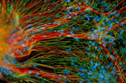 Currentsinbiology:  Derived From Human Embryonic Stem Cells, Precursor Neural Cells