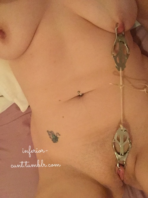 inferior-cunt:  Part 2 of the ways I can hurt myself.  I haven’t got a story for this… Just “ow ow ow ow ow ow” 