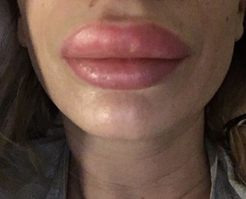 Porn lissybaybe:  My new cocksucking lips…  photos