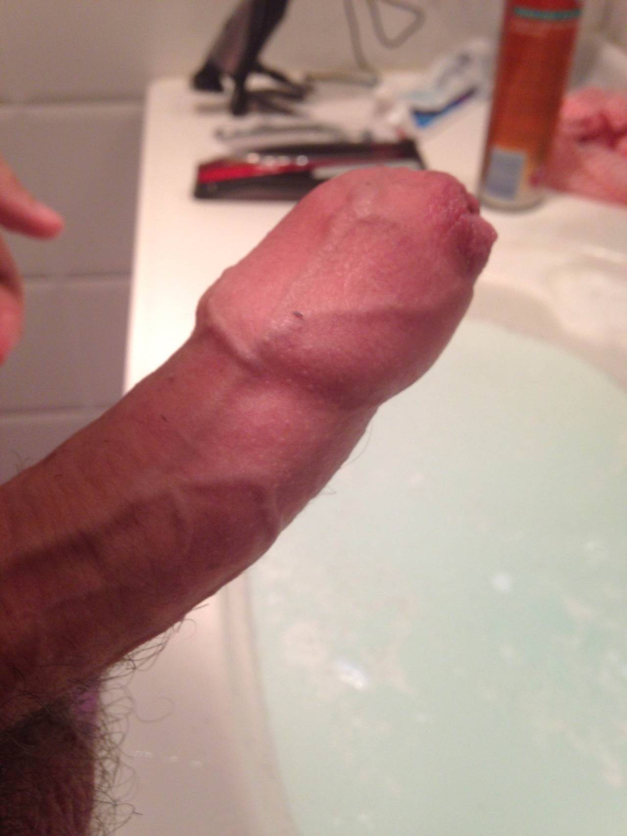 All For Foreskin