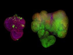 bpod-mrc:   Poised for Growth   To explore the link between sugar and cancer, scientists engineered fruit flies to activate the genes Ras and Src, which play a role in a variety of cancers in people. The genes were specifically activated in cells within