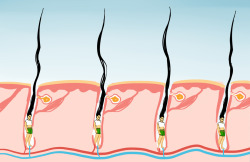 tangooooooooo:  看到一张治疗秃头的毛孔示意图就是这样被骗的。 