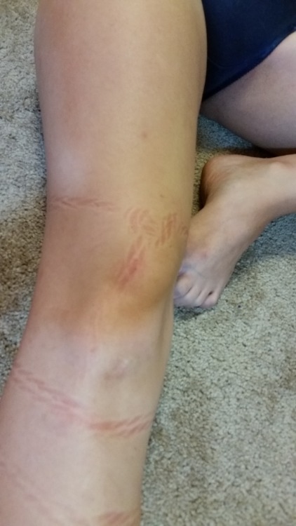 Last Sunday, Radical Girl came over and I practiced rope on her. These are the marks left behind aft