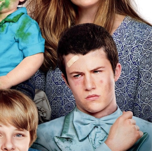 Dylan Minnette: prone to forehead injuries, must protect at all costs