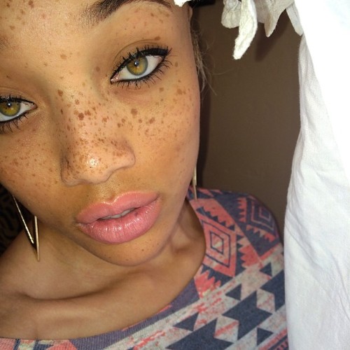 famousbutunknown:  IG: cocaine_lorraine  Damn!! #freckles