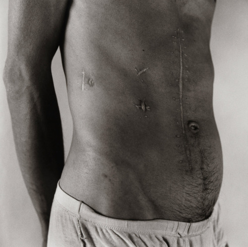 theories-of:  Peter Hujar  Pascal Imbert Scarred Abdomen 1985