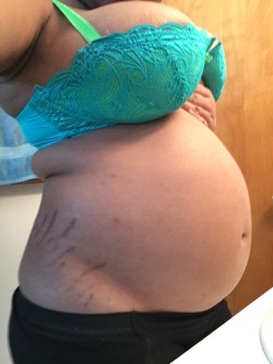 mothermunchies:  215…I gained 7 pounds in 2 weeks. Behold my false pregnancy belly!!!!