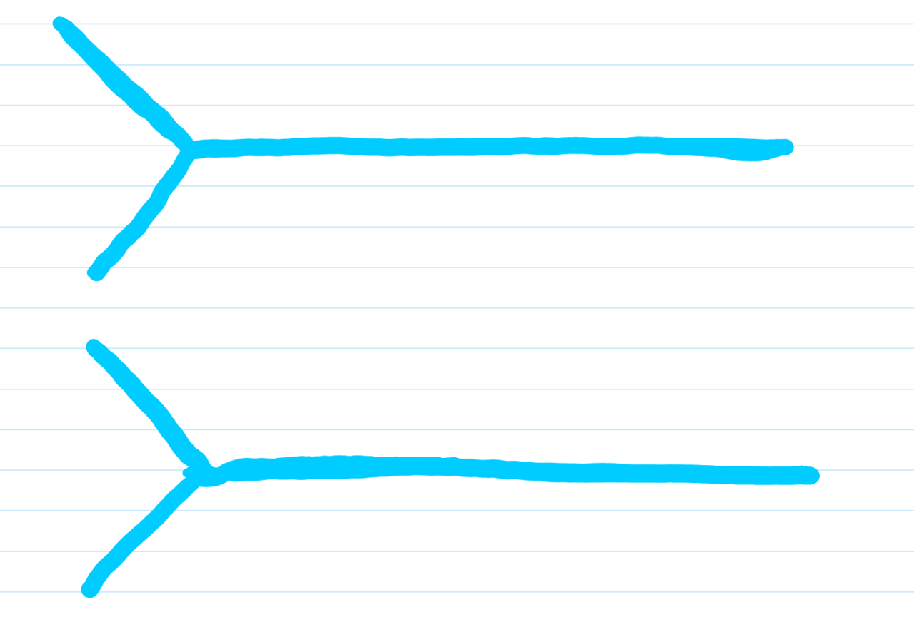 Medschoolmanic Presents: Brachial Plexus Made Easy!