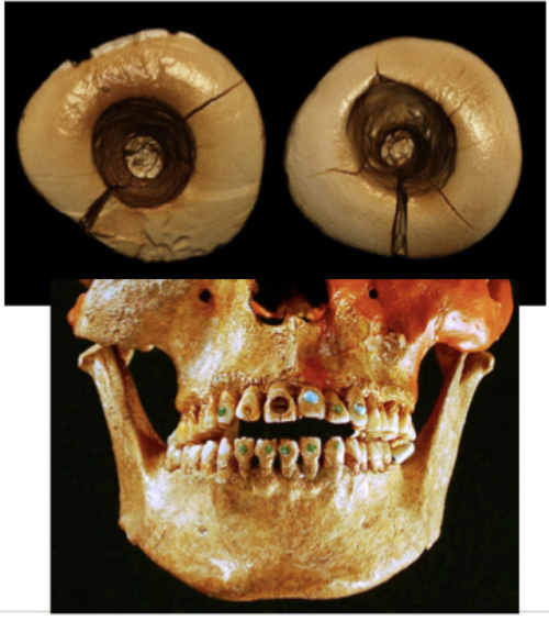 kaijutegu:This arrangement of pictures of teeth looks like a skull with big, bulgy googly eyes and I