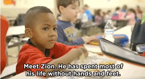 huffingtonpost:  WATCH: Boy, 8, Is First Child Ever To Receive Double Hand Transplant“Never