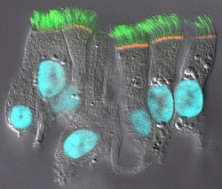 currentsinbiology:  CFTR (cystic fibrosis