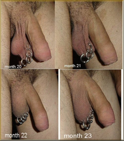 ban-ric:  (These pictures aren’t mine, here is the source)If you’re ever feeling disappointed about being circumcised, you can always restore your foreskin like the man in the pictures above did. It only took him 2 years to achieve the last picture,