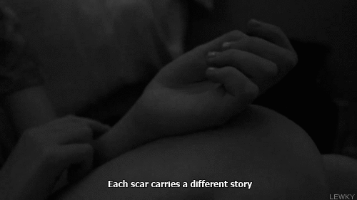 lonelinesstwinkle:  each scar … | via Tumblr pe We Heart It. 