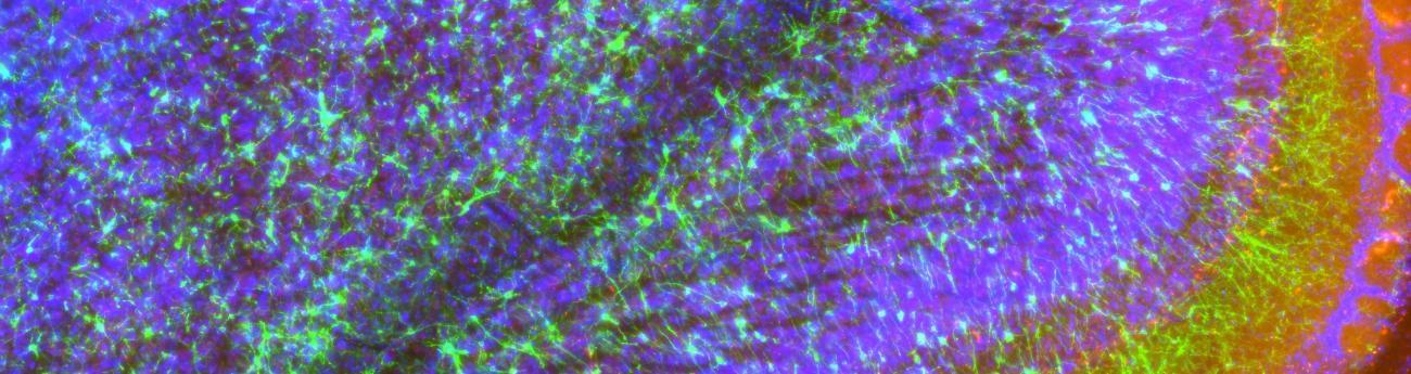 neurosciencestuff:
“ (Image caption: New neurons in an adult brain. Credit: © Mariana Alonso and Pierre-Marie Lledo – Institut Pasteur)
New neurons in the adult brain are involved in sensory learning
Although we have known for several years that the...