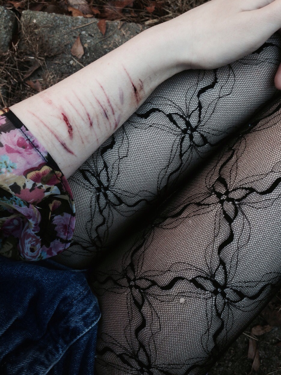 babymasochist:  i feel like a broken doll