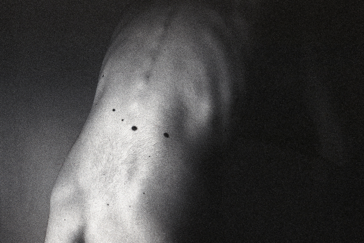 picsofyou:Birthmarkswith Canon Ft Qlfollow me on: Flickr | Facebook | Society 6