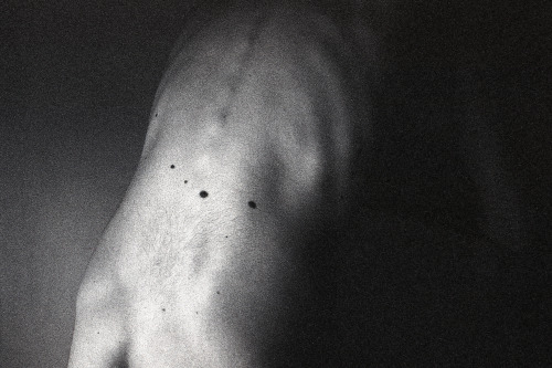 picsofyou:Birthmarkswith Canon Ft Qlfollow me on: Flickr | Facebook | Society 6