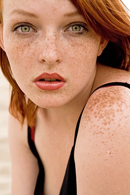 red-haired-girl:  Wow! What a combination of red hair, green eyes and freckles!