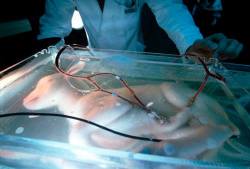 spookydashingyounghero:  basketofarrows:  animalsandtrees:  The Artificial Womb Is Born &ldquo;In Tokyo, researchers have developed a technique called EUFI — extrauterine fetal incubation. They have taken goat fetuses, threaded catheters through the