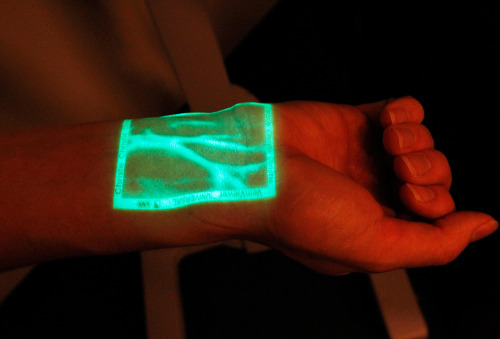 medicalstate:VeinViewer by Christie Medical Holdings. An infrared device that detects the location of a patient’s veins and projects them on the skin so doctors and nurses don’t miss. 