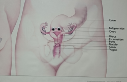 hypercalcium:  reallymadscientist:Thought I’d liven up one of the rooms at the OBGYN (via)  “YOOOOOO WHO HAS 16 FINGER LIKE PROJECTIONS AND KNOWS HOW TO PARTY?! THIS VAAAAG!”
