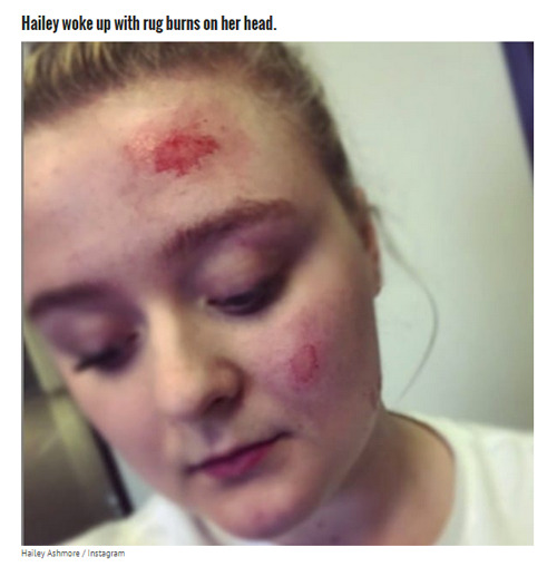 lastlips:  misscherry:  beloved-rose:    Teen With Epilepsy Has A Seizure When Her