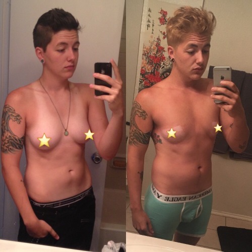 seethestarsablaze:  seethestarsablaze:  Left: pre-t, age 19  Right: 1.5 years on T, age 24 (current)  Top surgery in 100 days! 