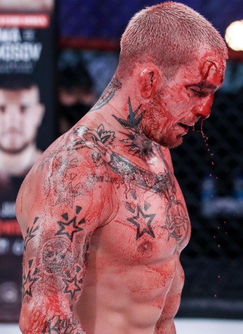 Bloody Fighter Austin Vanderford