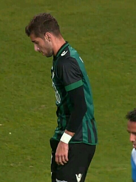 footbulging