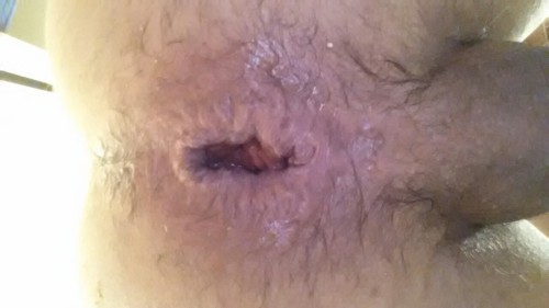 My wrecked hole. porn pictures