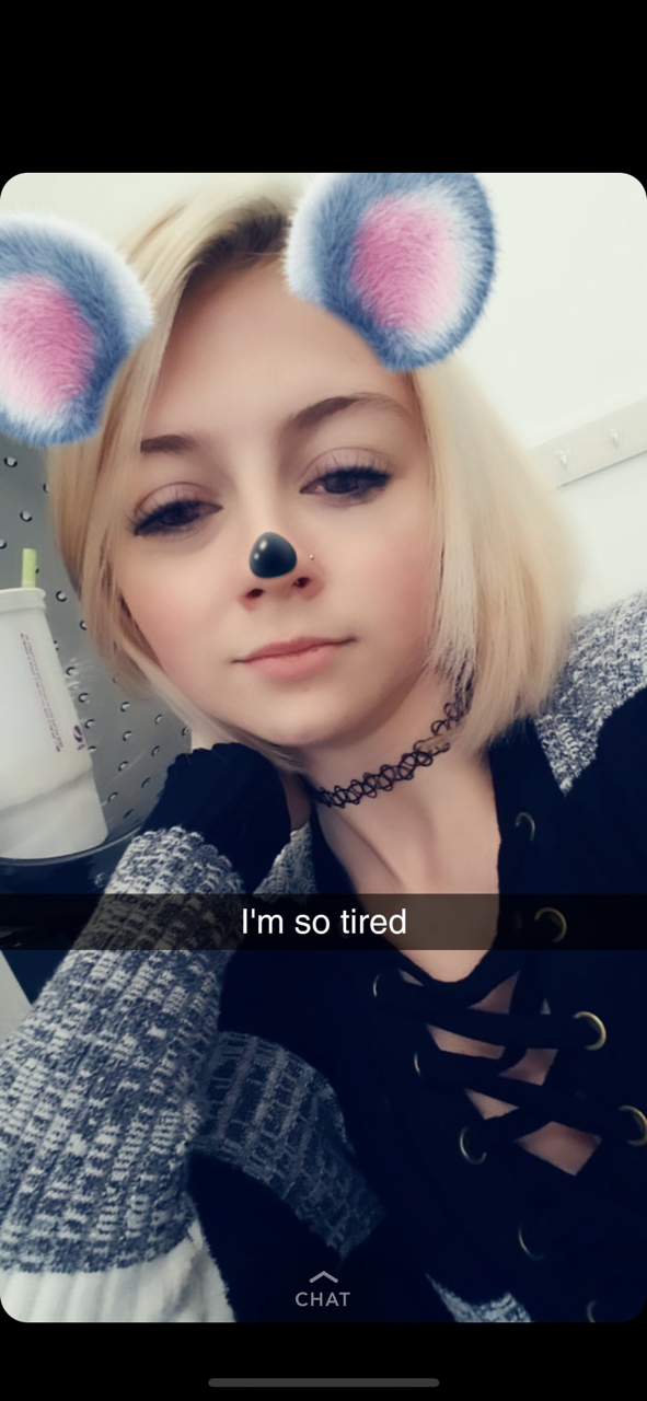 😵