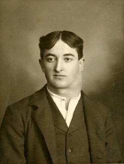Portrait of a man with a goiter by John D. Strunk, 1920&rsquo;s.