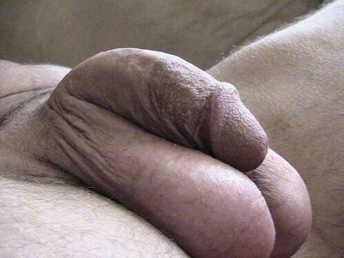 frenulumist:  Beautiful
